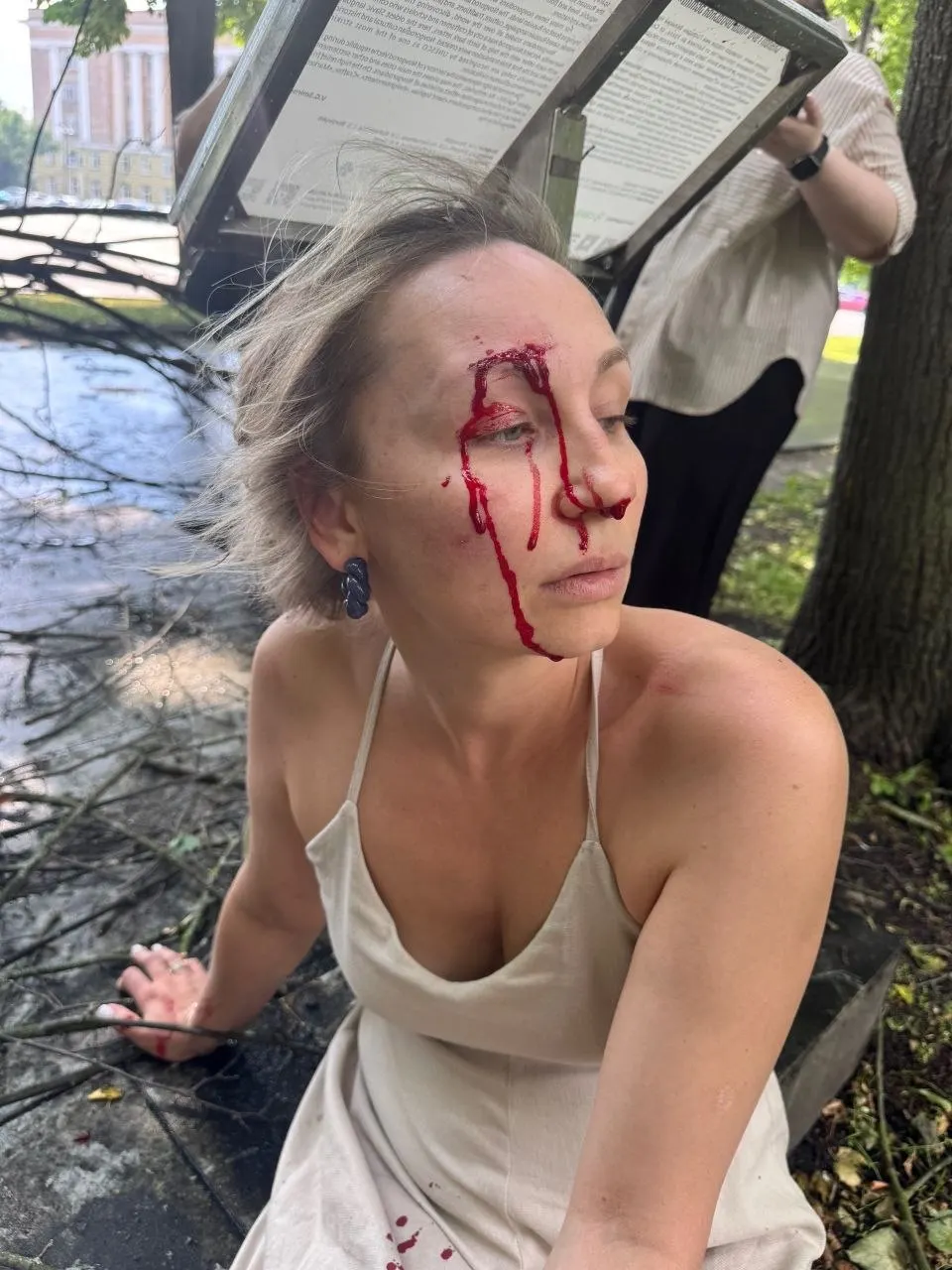 В Кремлёвском парке Великого Новгорода на туристку упало сухое дерево, она получила травмы. Проводится проверка благоустройства и деятельности ответственной организации.