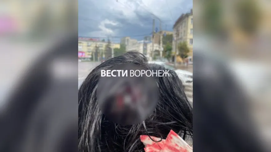 10 июля у дома на Кольцовской во время непогоды с фасада отвалилась лепнина; девушка получила сотрясение и намерена добиваться компенсации. Управляющая компания пока молчит.